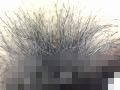 100人のまん毛 第6集