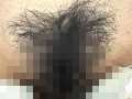 100人のまん毛 第6集
