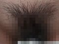 100人のまん毛 第6集