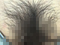 100人のまん毛 第6集