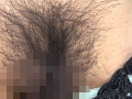 100人のまん毛 第6集