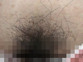 100人のまん毛 第6集