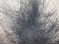 100人のまん毛 第9集