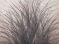 100人のまん毛 第8集