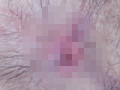 100人の尻穴 第8集