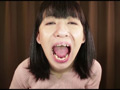 絶景口内検診2