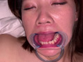 口腔（1）