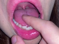 口腔（2）