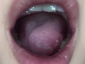 口腔（2）