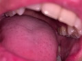 口腔（3）
