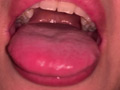 口腔（4）
