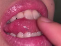 口腔（4）