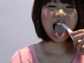 歯03