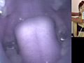 歯04