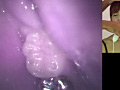 歯04