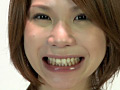 歯06