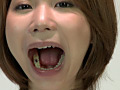 歯06