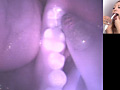 歯08