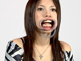 歯09