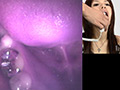 歯09