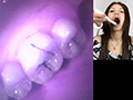 歯09