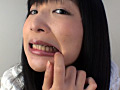 歯10