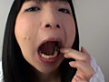 歯10