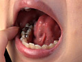 歯10