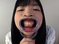 歯10
