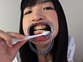 歯10