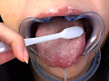 歯10