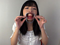 歯10