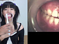 歯11