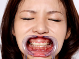 歯12