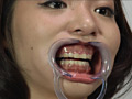 歯12