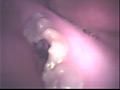 歯12