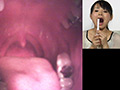 歯14