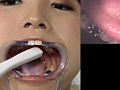 歯14