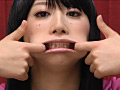 歯15