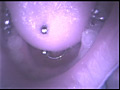 歯16
