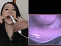 歯19