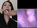 歯19