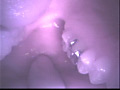 歯19