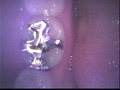 歯18