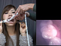 歯18