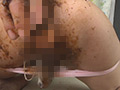 二穴交互挿入うんこセックス