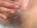 美熟女のアナル拡張