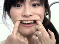 歯フェチ！処置室 さらちゃん 銀歯がキラリ