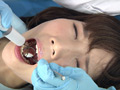 歯フェチ！処置室 ゆうこちゃん 銀歯がキラリ