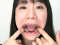 歯フェチ！レア美熟女の銀歯観察 優奈